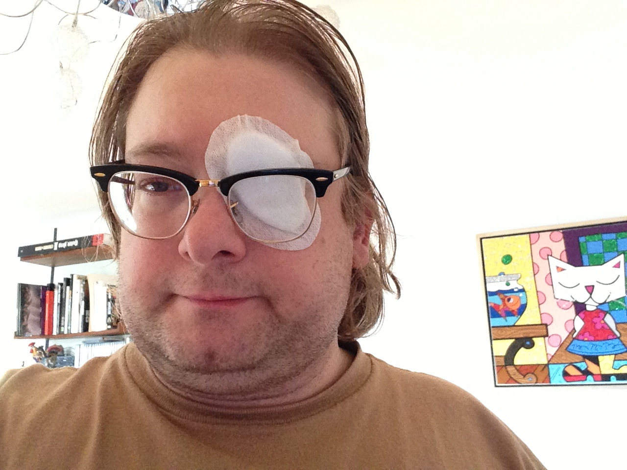 Einen Verband aufs Auge macht den Kerl nicht unbedingt schöner.